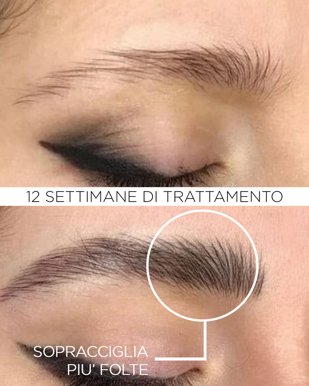 Siero Crescita Sopracciglia | Venus